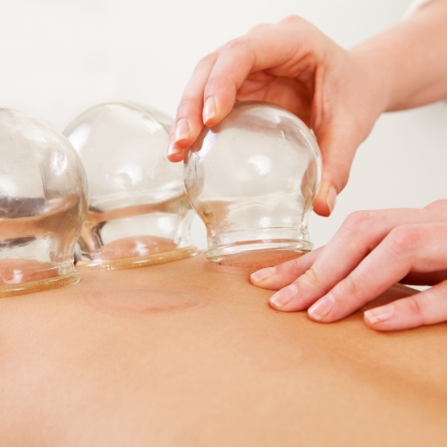 physical-therapy-clinic-cupping-marketplace-pt-chino-ca