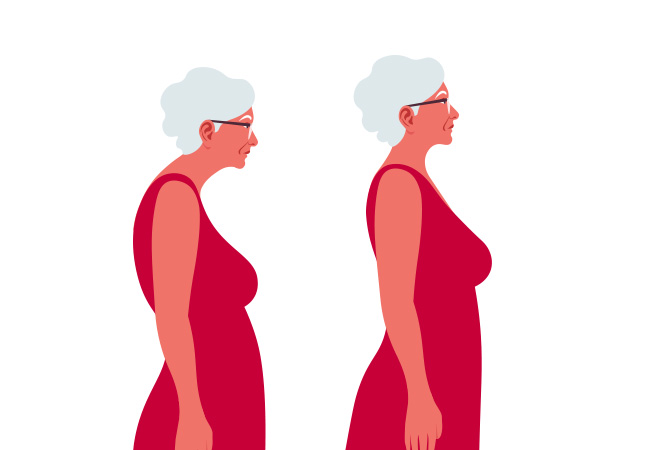 How Posture Affects Neck and Shoulder Health